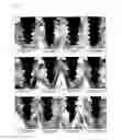 Fig. 08 - DENTAL MEMBER