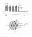 Fig. 10 - Toothbrush comprising asymmetrically oriented tufts of bristles