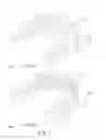Fig. 04 - Dental Carrier
