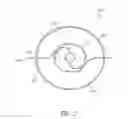 Fig. 03 - ANCHORING MECHANISMS AND SYSTEMS FOR ENDOLUMINAL DEVICES