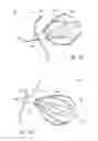 Fig. 04 - ANCHORING MECHANISMS AND SYSTEMS FOR ENDOLUMINAL DEVICES