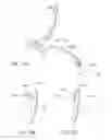 Fig. 14 - ANCHORING MECHANISMS AND SYSTEMS FOR ENDOLUMINAL DEVICES