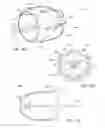 Fig. 15 - ANCHORING MECHANISMS AND SYSTEMS FOR ENDOLUMINAL DEVICES