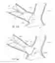 Fig. 17 - ANCHORING MECHANISMS AND SYSTEMS FOR ENDOLUMINAL DEVICES