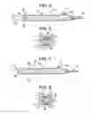 Fig. 06 - Intraocular lens delivery device and method of use