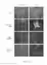 Fig. 11 - INTRAOCULAR LENS AND METHOD OF MANUFACTURING THE SAME
