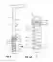 Fig. 05 - Vocal cord medialization