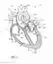 Fig. 03 - INFLATION MEDIA FOR IMPLANTS