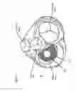 Fig. 02 - Cardiac prosthesis stabilization system