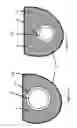 Fig. 04 - Cardiac prosthesis stabilization system