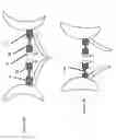 Fig. 06 - Cardiac prosthesis stabilization system