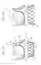 Fig. 15 - Holder and deployment system for surgical heart valves