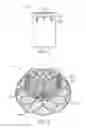 Fig. 03 - Clocking valve retainer
