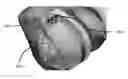 Fig. 01 - METHOD AND NODE FOR MANUFACTURING A SURGICAL KIT FOR CARTILAGE REPAIR