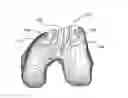 Fig. 01 - Extended patellofemoral