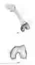 Fig. 02 - Extended patellofemoral