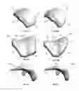Fig. 06 - Extended patellofemoral