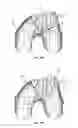 Fig. 08 - Extended patellofemoral