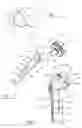 Fig. 02 - Implant