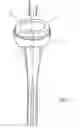 Fig. 02 - HUMERAL COMPONENT OF A SHOULDER JOINT PROSTHESIS