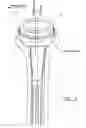 Fig. 06 - HUMERAL COMPONENT OF A SHOULDER JOINT PROSTHESIS