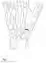 Fig. 02 - Interposition implants for the hand