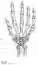 Fig. 07 - Interposition implants for the hand