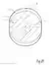 Fig. 11 - Interposition implants for the hand