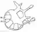 Fig. 01 - Expandable Ring Intervertebral Fusion Device