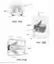 Fig. 17 - Modular plate and cage elements and related methods
