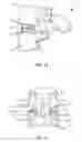 Fig. 08 - Spinal implant system and method