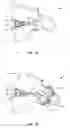 Fig. 09 - Spinal implant system and method
