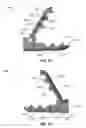 Fig. 35 - Expandable interbody devices and related instruments and methods for spinal fusion surgery