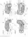 Fig. 02 - Adjustable arcuate implant