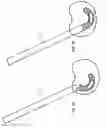 Fig. 08 - Adjustable arcuate implant