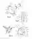Fig. 05 - Glenoid trial and implant assembly for reverse total shoulder arthroplasty and method of use
