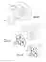 Fig. 07 - Glenoid trial and implant assembly for reverse total shoulder arthroplasty and method of use