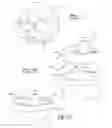 Fig. 08 - Glenoid trial and implant assembly for reverse total shoulder arthroplasty and method of use
