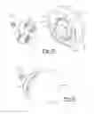 Fig. 09 - Glenoid trial and implant assembly for reverse total shoulder arthroplasty and method of use