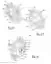 Fig. 10 - Glenoid trial and implant assembly for reverse total shoulder arthroplasty and method of use