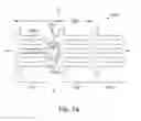 Fig. 17 - Thin-walled scaffolds having flexible distal end