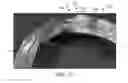 Fig. 19 - Thin-walled scaffolds having flexible distal end