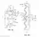 Fig. 10 - Thin-walled scaffolds having modified marker structure near distal end