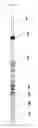 Fig. 05 - Highly retractable intravascular stent conveying system