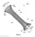 Fig. 10 - Stents and stent deployment devices