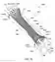 Fig. 11 - Stents and stent deployment devices