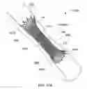 Fig. 12 - Stents and stent deployment devices