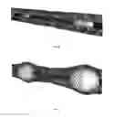 Fig. 31 - Stents and stent deployment devices