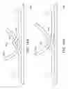 Fig. 15 - METHODS AND APPARATUS FOR ANCHORING WITHIN THE GASTROINTESTINAL TRACT