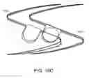 Fig. 18 - METHODS AND APPARATUS FOR ANCHORING WITHIN THE GASTROINTESTINAL TRACT